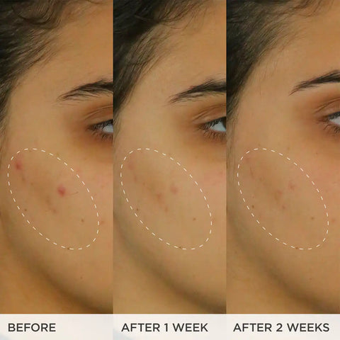 The Brightening Serum